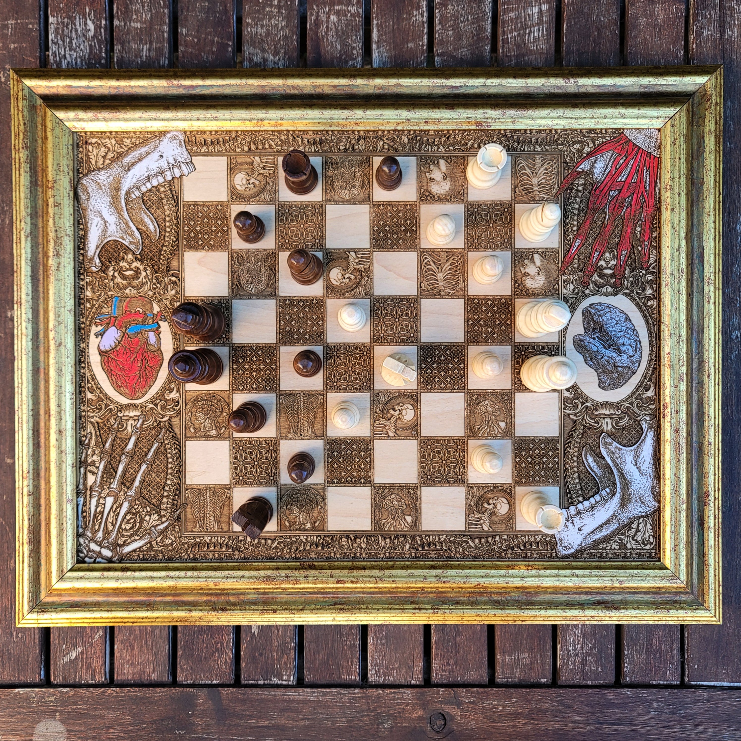 Human Anatomy Chess Board - A3 Large Size